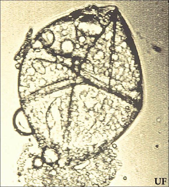 Figure 8. Egg of proturan from the family Eosentomidae (1200x).