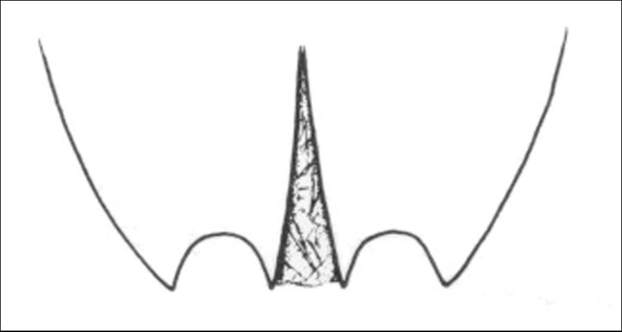 Figure 6. Enlarged elytral apices of female A. patricius.