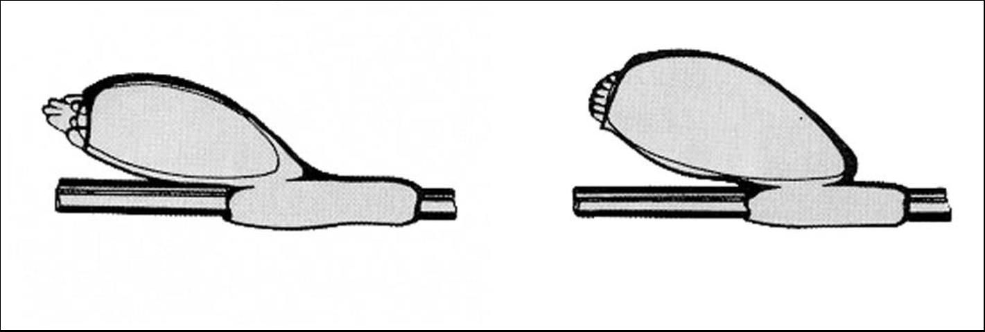 Figure 1. Crab louse egg (left); body louse egg (right).