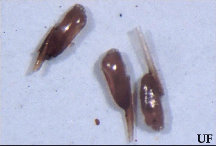 Figure 4. (Dark) nits (eggs) of head lice, Pediculus humanus capitis De Geer, glued on pieces of hair shafts.
