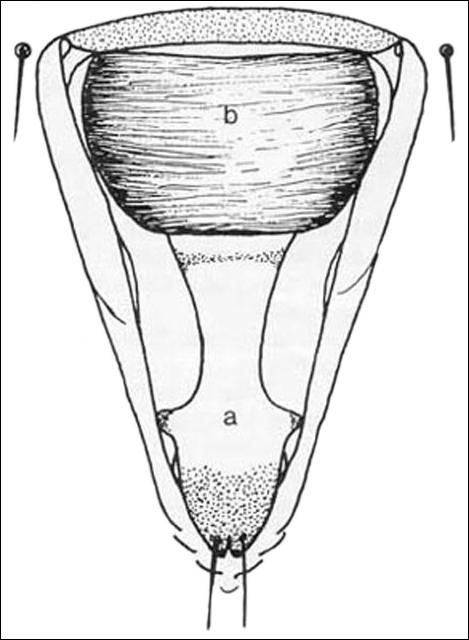 Figure 2. Vasiform oriface [ a - linguala, b - operculum ] of the nymph of the bayberry whitefly, Parabemisia myricae (Kuwana)