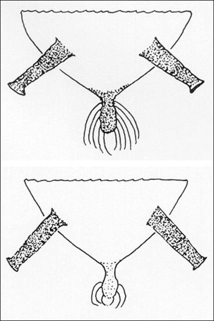 Figure 5. Other aphids are similar in appearance to Aphis gossypii (Glover), the melon or cotton aphid. One other species commonly encountered is A. spiraecola Patch, the spirea aphid. In A. gossypii (bottom) the cauda is pale to dusky and has two or three pairs of setae, in A. spiraecola (top) the cauda is dark brown to black and has five or six pairs of setae.