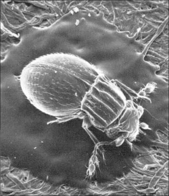 Figure 1. Undescribed species of featherwing beetle (Ptiliidae), less than 1 mm long.