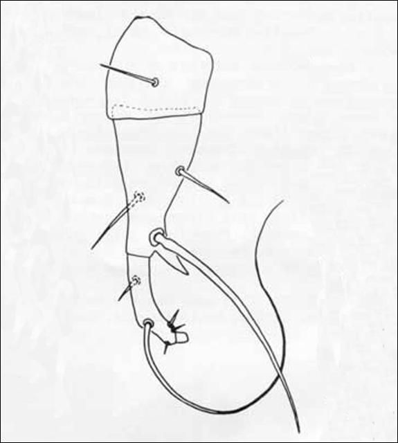 Figure 5. Leg IV of male broad mite, Polyphagotarsonemus latus (Banks).