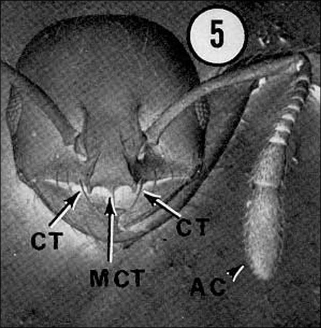 Figure 4. Head of a minor worker of the red imported fire ant, Solenopsis invicta Buren. AC = antennal club; CT = clypeal tooth; MCT = medial clypeal tooth.