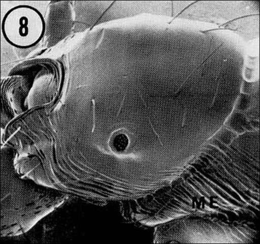 Figure 5. Propodeum (the first abdominal segment) of a minor worker of the red imported fire ant, Solenopsis invicta Buren.