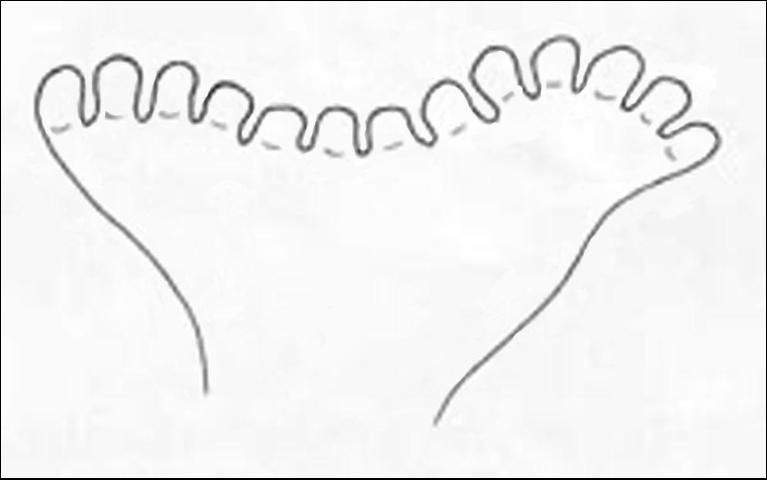 Figure 5. Anterior spiracles of Anastrepha obliqua (Macquart) larva