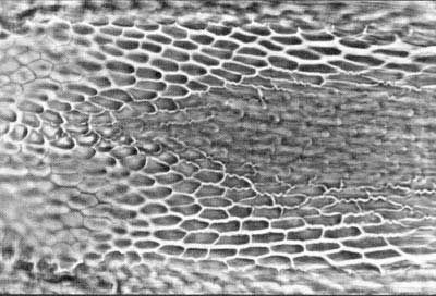 Figure 11. Micro reticulation near base of the ovipositor of an adult female guava fruit fly, Bactrocera correcta (Bezzi).