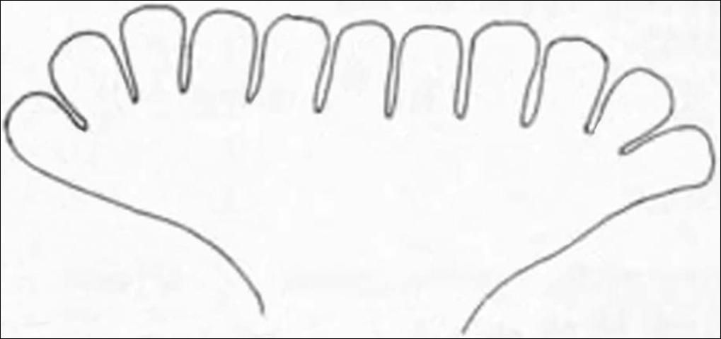 Figure 7. Anterior spiracles of larva of the Mediterranean fruit fly, Ceratitis capitata (Wiedemann).