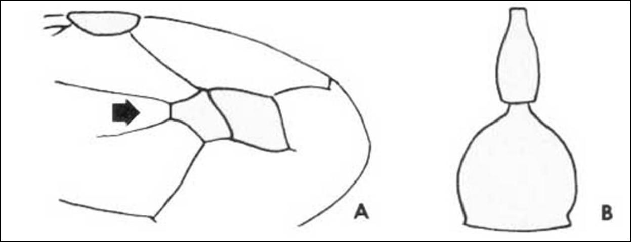 Figure 3. Zethus spp. wing (A) and abdomen (B).