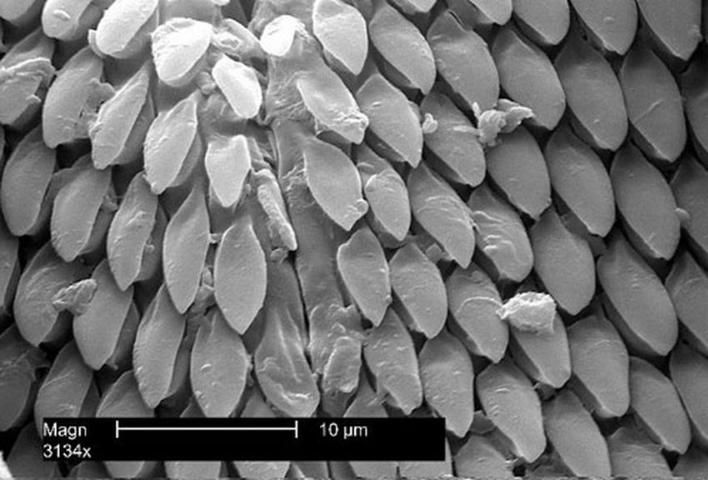 Figure 10. Enlarged view of the hundreds of sharp, backward-directed barbs on the mouthparts of an American dog tick, Dermacentor variabilis (Say).