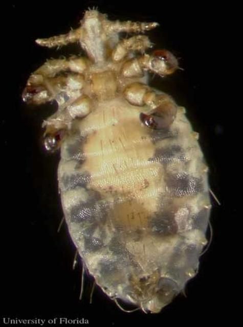 Figure 4. Ventral view of an adult little blue cattle louse, Solenopotes capillatus (Enderlein).