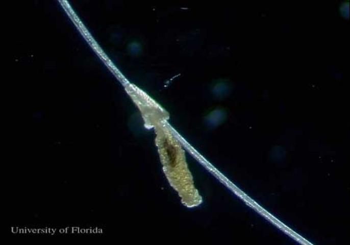 Figure 2. Egg of the little blue cattle louse, Solenopotes capillatus (Enderlein), cemented to a hair.