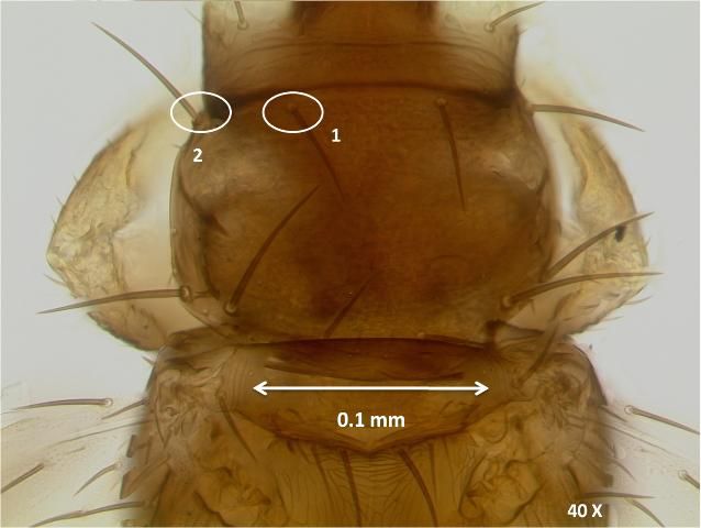 Figure 5. Prothorax of an adult common blossom thrips, Frankliniella schultzei Trybom, showing the anteromarginal setae (1) slightly shorter than anteroangular setae (2) on the anterior of the prothorax.
