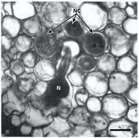 Figure 4. Cross section of Poncirus trifoliata root parasitized by the Poncirus biotype of the citrus nematode, Tylenchulus semipenetrans (Cobb 1913). Note the nematode (N) head surrounded by the nurse cells (NC).