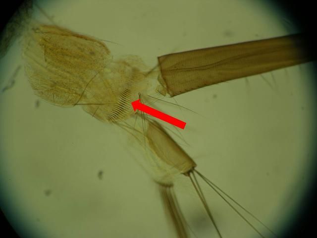 Figure 6. Bar-like comb scales located on the eighth section of the abdomen of Culiseta melanura larva.
