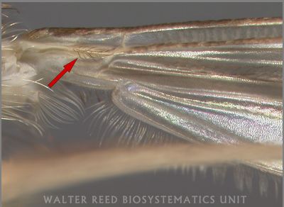 Figure 9. Distinguishing hairs arising from the ventral side of the wing of Culiseta melanura.