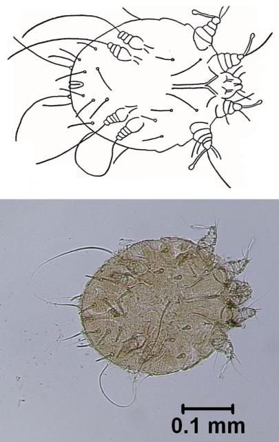 Figure 1. Sarcoptic mange mite (Sarcoptes scabei). Adult female specimen from a dog.
