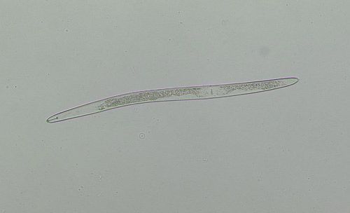 The body of Helicotylenchus spp. and other spiral nematodes curve into a spiral when the nematode is dead or relaxed. This moving nematode is outstretched.