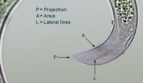 The tail of Helicotylenchus pseudorobustus is asymmetrical and has a projection on the end.