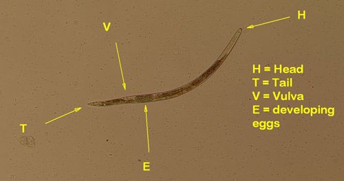 Figure 1. An amaryllis lesion nematode. The vulva is located about 78% of the nematode's body length from the anterior.