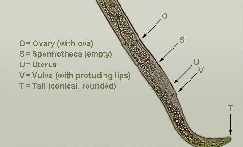 Figure 3. The tail region of a female amaryllis lesion nematode with conical, rounded tail, protruding vulval lips, and empty spermotheca.