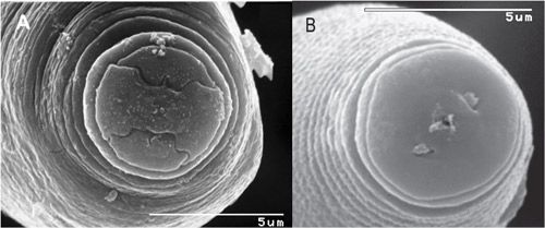 Figure 7. Scanning electron microscopy of the nematode frontal-view is required to separate Pratylenchus hippeastri from Pratylenchus scribneri. A: The oral disc of Pratylenchus scribneri is divided. B: the oral disc of Pratylenchus hippeastri is fully fused. Adapted from Inserra et al., 2007 and De Luca et al., 2010.