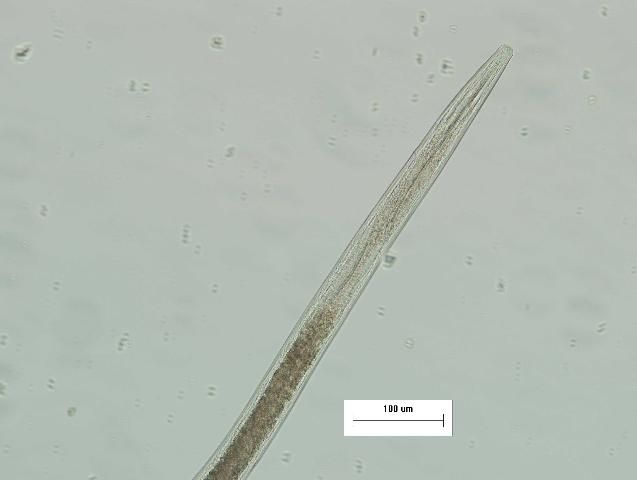 Figure 2. Needle nematode head with stylet under high magnification.