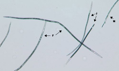 Figure 6. Sting nematode females (F), males (M), and juveniles (J) under high magnification.
