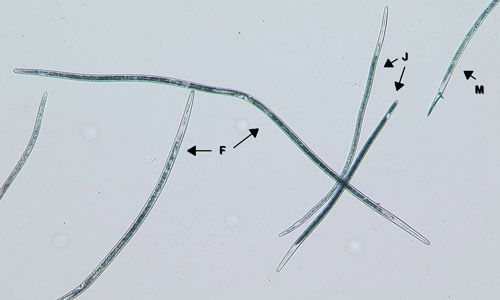 Sting nematode females (F), males (M), and juveniles (J) under high magnification.