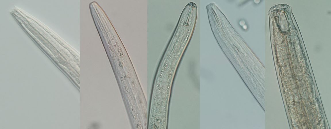 Different nematodes (from left to right): bacterivore, fungivore, herbivore, omnivore, predator. 
