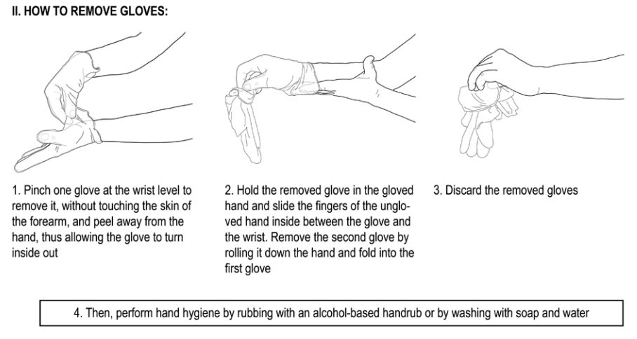 Sterile glove removal techniques. 