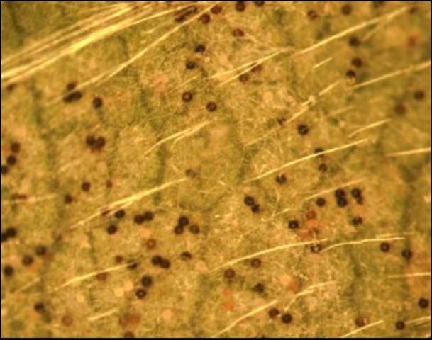 Figure 5. Micrograph of Podosphaera aphanis cleistothecia on leaf surface.