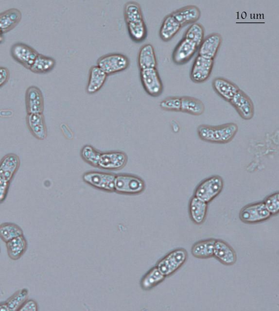Figure 2b. Microscopic view of two-celled conidia of Marsonina rosae, 400x.