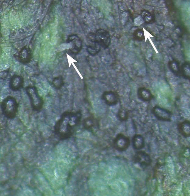 Figure 2a. Black acervuli on a lesion caused by Marsonina rosae. Note the white masses of conidia (arrows), 50x.