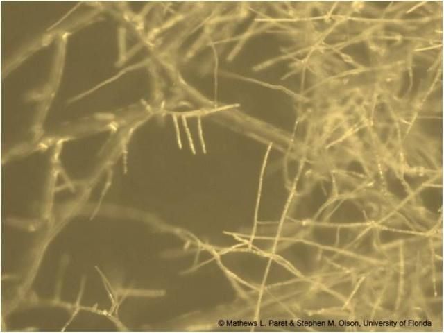 Figure 21. Network of fine white mycelial filaments called hyphae on an artificial medium.