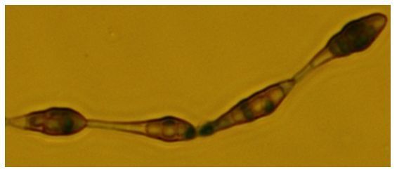 Figure 3. A chain of conidia produced by Alternaria sp. isolated from imported Mexican plum tomatoes (400 × magnification).