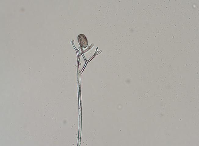 Microscopic image of sporangiophore with sporangia attached.