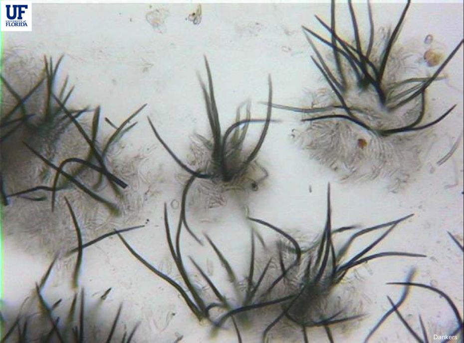 Hair-like structures (setae) and conidia (spores) of the fungus.