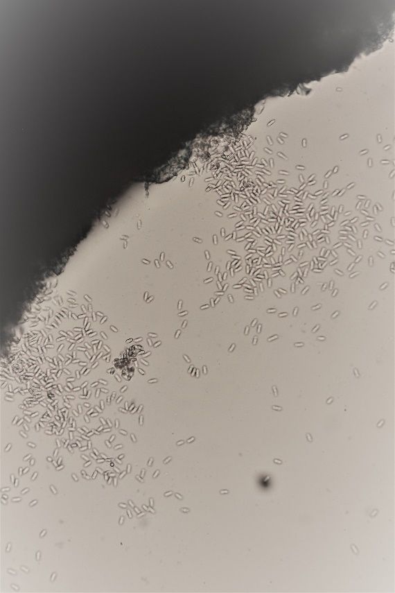 Conidia and fruiting structures (acervuli) of Colletotrichum on watermelon leaf surface.
