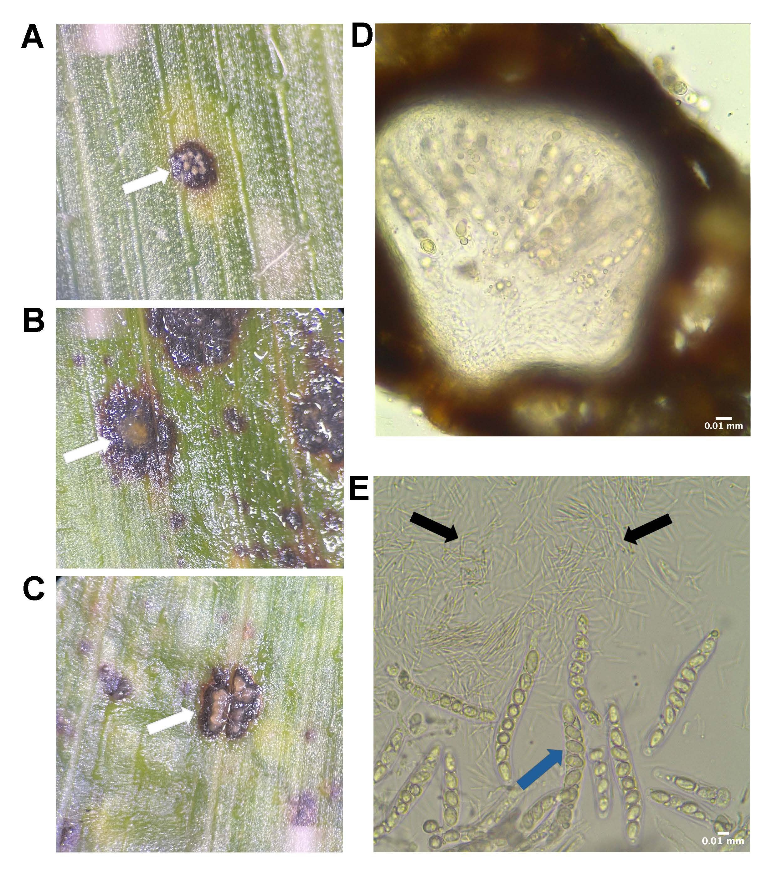 Observations of tar spot stromata with (A) white, (B) translucent, (C) orangish exudation of a mucilaginous mass. Microscopic visualization of Phyllachora maydis showing (D) stroma, (E) conidia spores (black arrow), and (E) ascospores (blue arrow).