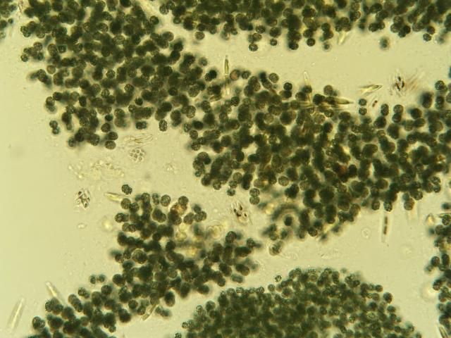 Figure 2. Microscopic image of blue-green algae (Microcystis) collected at Port Mayaca, June 2018.