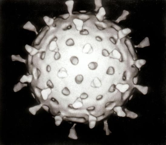 Figure 1. A Rotavirus particle. Rotavirus can cause serious diarrhea in infants.