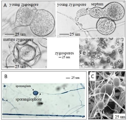 Figure 2. Morphological characterization of M. elongata in culture. (A) Zygospore: M. elongata can be heterothallic and have diploid reproductive stage in its life cycle. After the compatible hyphal tips contact each other, the progametangia grow out, fuse, and form gametangia. The swollen gametangia develop a septum at their lower part to delimit the future zygospore. The zygospores can be formed at temperatures between 20°C and 30°C. (B) In the asexual reproduction process, the special hyphae of M. elongata form sporangiophores (50 µm–>300µm), which bear sporangia (10–30 µm diameter). Sporangiospores are then produced in the sporangia. (C) Chlamydospores. M. elongata can form thick-walled spores (chlamydospores) in order to survive in harsh conditions (e.g., hot, cold, or dry seasons, or unfavorable nutritional conditions).