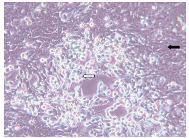 Figure 2. Photomicrograph of cell culture (epithelioma papillosum of carp) that is infected with SVCv. Black arrow points to cells that appear normal, white arrow to cells dying from SVCv.