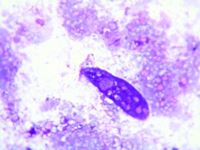 Figure 26. This elongated ciliate was readily identified in a fecal cytology specimen stained with Wright-Giemsa. The morphology of this organism is suggestive of Amphileptus punctatus.