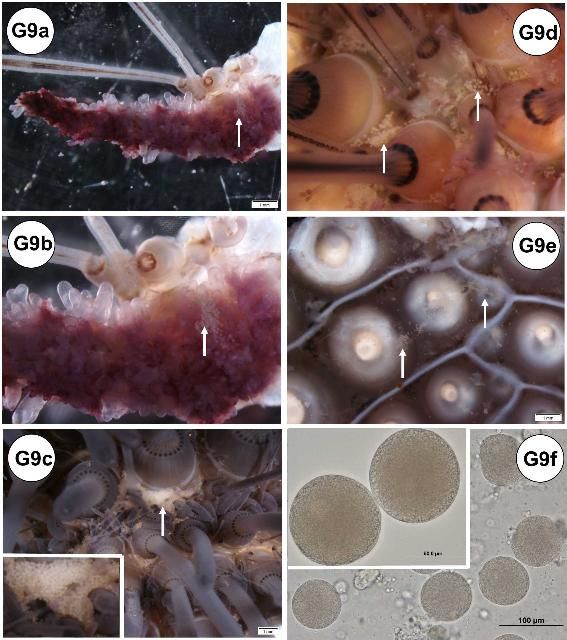 Figure G9-1. Gross recognizable abnormalities (some pathologies) shown. (a) Gill that had oocytes adhered at the surface of mature female specimen. (b) Enlarged view of (a). (c) Test with oocytes adhered at the surface of mature female specimen. Inset of (c) showing high magnification of oocytes (white thick arrow). (d) Test external view. (e) Test internal side view of (d). (f) Tissue wet mount taken from the oocytes adhered to the test surface of (c). Inset of (f) showing high magnification of the tissue wet mount of oocytes taken from the test surface of (d). Note that these oocytes possibly originated from fully mature female Diadema (see histology, disease, and abnormalities section). (g) Normal view of peristomial membrane of juvenile. (h–i) Artifact needle puncture mark (hollow white arrow) of juvenile specimens. (j) Brown pigmentation in the ampullae of ambulacrum test plate of aboral side. (k) Brown pigmentation in the ampullae of ambulacrum test plate of oral side. (l) Longitudinally sectioned view of the ambulacrum test plate showing the brown pigmentation in the ampullae. (m) Spine tubercle shown where the spine itself was broken or pulled out. (n) Same specimen as (m), but the area had two spine tubercles, and healing occurred indicated by shiny appearance. (o) Brown pigmentation in the hemal vessel of small intestine. (p) Brown pigmentation in the hemal vessel of both small and large intestine border. Ampu = ampulla; Arrow head = spine tubercle; Hollow white arrow = needle puncture mark; LI = large intestine; SI = small intestine; Sp = spine; White thick arrow = egg mass; White thin arrow = brown pigmentation.