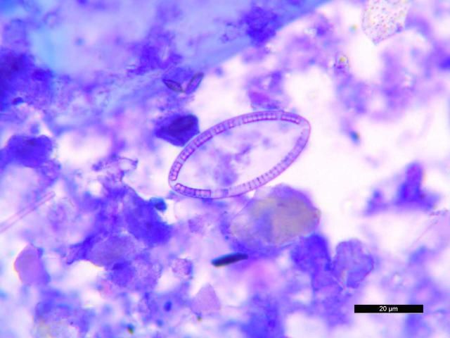 Figure 27. An example of a diatom observed in a Wright-Giemsa-stained fecal direct smear of D. antillarum collected in the Middle Keys in March 2015.