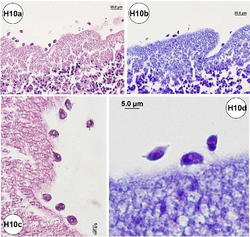 Figure H10-1. Histopathological section of the small intestine showing amoeba. (a) Cytoplasm of basophilic stained amoeba found at the surface of epithelial cell lining. (b) Same area of (a) stained with Thionin. (c) High-power magnification of (a). (d) High-power magnification of (b). (e) Moderate-power magnification showing amoeba (arrow heads) and gut epithelial cell erosion. (f) High-power magnification of amoeba. (g) High-power magnification view of an amoeba cell with pseudopod (lightly eosinophilic stained) and food vacuoles (strongly eosinophilic stained). (h) Another view of an amoeba using the highest power magnification possible by light microscopy (1.6x converter lens along with 100x objective lens used).