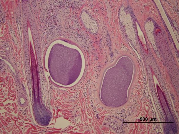 Microscopic image of two Besnoitia cysts within a skin biopsy obtained from a donkey with besnoitiosis. H&E 100x. 